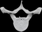 Bowhead Whale (Thoracic Vertebrae 4 (Axial) - Cranial)