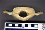Black Bear (Cervical Vertebrae 1 - Atlas (Axial) - Cranial)