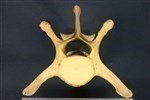 Bearded Seal (Lumbar Vertebrae Middle (Axial) - Cranial)