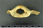 Black Bear (Cervical Vertebrae 1 - Atlas (Axial) - Cranial)