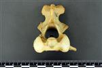 Black Bear (Cervical Vertebrae 2 - Axis (Axial) - Cranial)