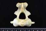 Black Bear (Cervical Vertebrae 2 - Axis (Axial) - Cranial)