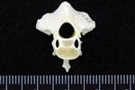 Trumpeter Swan (Cervical Vertebrae 2 - Axis (Axial) - Cranial)
