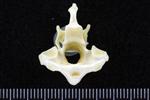 Trumpeter Swan (Cervical Vertebrae 2 - Axis (Axial) - Caudal)