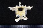 White-Winged Scoter (Thoracic Vertebrae 1 (Axial) - Cranial)