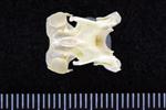 White-Winged Scoter (Cervical Vertebrae 3 (Axial) - Ventral)