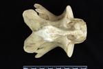 American Bison (Cervical Vertebrae 2 - Axis (Axial) - Dorsal)