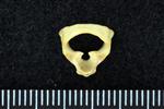 Glaucous Gull (Cervical Vertebrae 1 - Atlas (Axial) - Cranial)