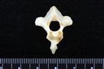 Northern Gannet (Cervical Vertebrae 2 - Axis (Axial) - Cranial)
