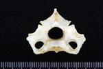 Northern Gannet (Cervical Vertebrae Last (Axial) - Cranial)