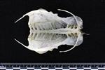Sharp Tailed Grouse (Thoracic Vertebrae Last (Penultimate) (Axial) - Ventral)