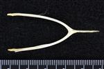 Willow Ptarmigin (Furcula (Axial) - Caudal)