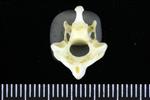 Emperor Goose (Cervical Vertebrae 2 - Axis (Axial) - Caudal)