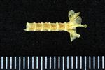 Candlefish (Cervical Vertebrae 1 - Atlas (Axial) - Ventral)