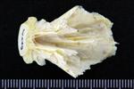 Pacific Cod (Basioccipital (Axial) - Dorsal)
