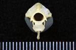 Common Goldeneye (Cervical Vertebrae 2 - Axis (Axial) - Cranial)