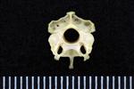 Common Goldeneye (Cervical Vertebrae 3 (Axial) - Cranial)