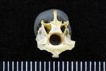 Common Goldeneye (Cervical Vertebrae 3 (Axial) - Caudal)