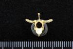 Common Goldeneye (Thoracic Vertebrae Middle (Axial) - Cranial)