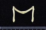 Common Goldeneye (Furcula (Axial) - Proximal)
