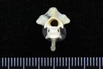 Mallard (Cervical Vertebrae 2 - Axis (Axial) - Cranial)