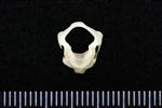 Canvasback (Cervical Vertebrae 1 - Atlas (Axial) - Cranial)