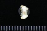 Canvasback (Cervical Vertebrae 1 - Atlas (Axial) - Dorsal)