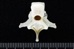 Great Blue Heron (Thoracic Vertebrae Middle (Axial) - Caudal)