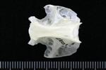 Great Blue Heron (Thoracic Vertebrae Middle (Axial) - Ventral)