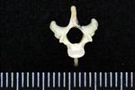 Northern Fulmar (Cervical Vertebrae 2 - Axis (Axial) - Cranial)