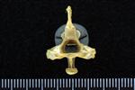 Common Loon (Cervical Vertebrae 2 - Axis (Axial) - Caudal)