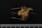 Northern Pintail (Thoracic Vertebrae Middle (Axial) - Ventral)