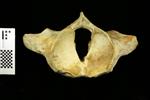 Humpback Whale (Cervical Vertebrae 1 - Atlas (Axial) - Cranial)