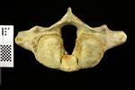 Humpback Whale (Cervical Vertebrae 1 - Atlas (Axial) - Caudal)
