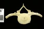 Humpback Whale (Thoracic Vertebrae 1 (Axial) - Cranial)
