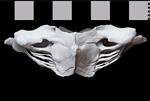 Bowhead Whale (Cervical Vertebrae 1 - Atlas (Axial) - Dorsal)