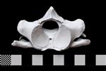 Bowhead Whale (Cervical Vertebrae 2 - Axis (Axial) - Cranial)