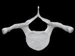 Bowhead Whale (Thoracic Vertebrae 2 (Axial) - Cranial)