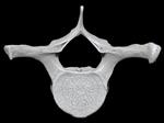 Bowhead Whale (Thoracic Vertebrae 3 (Axial) - Cranial)