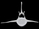 Bowhead Whale (Lumbar Vertebrae 3 (Axial) - Cranial)
