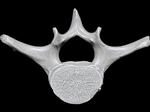 Bowhead Whale (Thoracic Vertebrae 9 (Axial) - Cranial)